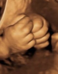 bebe echographie 4d - 3