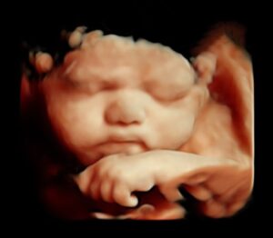 mimique bébé échographie