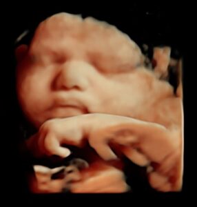 bébé échographie plaisir