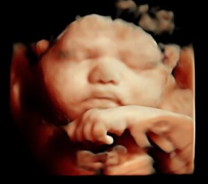 bébé échographie 4D